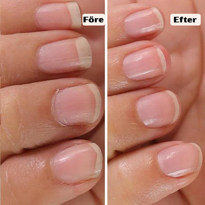 FlexoraCare I FlexNail Pro I Elektrisk Nagelfil med Justerbar Hastighet I Ergonomisk Design för Hemmanagelvård